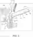 Fig. 04 - INFLATABLE PENILE PROSTHESIS WITH VALVES FOR INCREASING FLOW EFFICIENCY