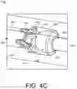 Fig. 07 - INFLATABLE PENILE PROSTHESIS WITH VALVES FOR INCREASING FLOW EFFICIENCY