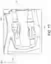 Fig. 21 - INFLATABLE PENILE PROSTHESIS WITH VALVES FOR INCREASING FLOW EFFICIENCY