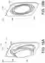 Fig. 22 - INFLATABLE PENILE PROSTHESIS WITH VALVES FOR INCREASING FLOW EFFICIENCY