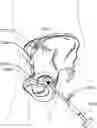 Fig. 01 - Method and system for aligning a prosthesis during surgery