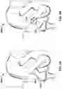 Fig. 07 - Method and system for aligning a prosthesis during surgery
