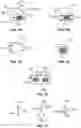 Fig. 10 - Method and system for aligning a prosthesis during surgery