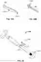 Fig. 20 - Method and system for aligning a prosthesis during surgery