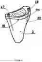 Fig. 06 - TIBIA CONDYLE RESURFACING PROSTHESIS