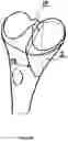 Fig. 09 - TIBIA CONDYLE RESURFACING PROSTHESIS