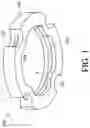 Fig. 02 - GLENOID IMPLANT HAVING MULTIPLE SECTIONS OF DIFFERING DIAMETERS