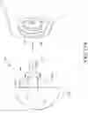Fig. 20 - GLENOID IMPLANT HAVING MULTIPLE SECTIONS OF DIFFERING DIAMETERS
