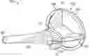Fig. 01 - TRI-FLANGE HUMERAL PROSTHESIS