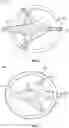 Fig. 03 - TRI-FLANGE HUMERAL PROSTHESIS