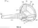 Fig. 06 - TRI-FLANGE HUMERAL PROSTHESIS