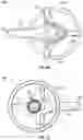Fig. 07 - TRI-FLANGE HUMERAL PROSTHESIS