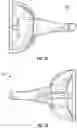 Fig. 08 - TRI-FLANGE HUMERAL PROSTHESIS