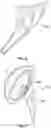 Fig. 11 - TRI-FLANGE HUMERAL PROSTHESIS