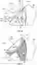 Fig. 12 - TRI-FLANGE HUMERAL PROSTHESIS
