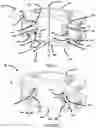 Fig. 04 - MOTION PRESERVING SPINAL TOTAL DISC REPLACEMENT APPARATUS, METHOD AND RELATED SYSTEMS