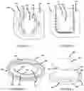 Fig. 08 - MOTION PRESERVING SPINAL TOTAL DISC REPLACEMENT APPARATUS, METHOD AND RELATED SYSTEMS