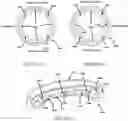 Fig. 10 - MOTION PRESERVING SPINAL TOTAL DISC REPLACEMENT APPARATUS, METHOD AND RELATED SYSTEMS