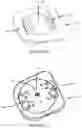 Fig. 13 - MOTION PRESERVING SPINAL TOTAL DISC REPLACEMENT APPARATUS, METHOD AND RELATED SYSTEMS