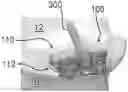 Fig. 01 - Expandable intervertebral implant