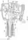 Fig. 15 - DUAL-ACTION EXPANDABLE INTERVERTEBRAL IMPLANTS
