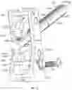 Fig. 18 - DUAL-ACTION EXPANDABLE INTERVERTEBRAL IMPLANTS