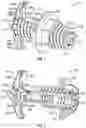 Fig. 02 - Interspinous process implant