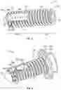 Fig. 03 - Interspinous process implant
