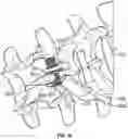 Fig. 14 - Interspinous process implant