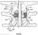 Fig. 23 - Interspinous process implant
