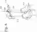 Fig. 08 - Devices and methods for inter-vertebral orthopedic device placement