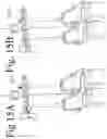Fig. 17 - Devices and methods for inter-vertebral orthopedic device placement