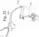 Fig. 35 - Devices and methods for inter-vertebral orthopedic device placement