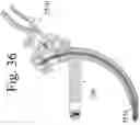 Fig. 38 - Devices and methods for inter-vertebral orthopedic device placement