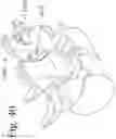 Fig. 42 - Devices and methods for inter-vertebral orthopedic device placement
