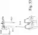 Fig. 55 - Devices and methods for inter-vertebral orthopedic device placement