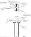 Fig. 05 - Minimally invasive use of robotic appendage for surgery and expansive device and surgical implant