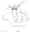 Fig. 06 - Minimally invasive use of robotic appendage for surgery and expansive device and surgical implant