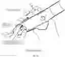 Fig. 11 - Minimally invasive use of robotic appendage for surgery and expansive device and surgical implant