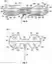 Fig. 05 - BALANCING DEVICE FOR ARTHROPLASTY AND METHODS FOR USE