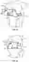 Fig. 21 - BALANCING DEVICE FOR ARTHROPLASTY AND METHODS FOR USE