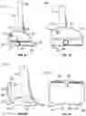 Fig. 23 - BALANCING DEVICE FOR ARTHROPLASTY AND METHODS FOR USE