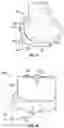 Fig. 25 - BALANCING DEVICE FOR ARTHROPLASTY AND METHODS FOR USE