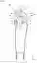Fig. 08 - Multi-articulated link knee joint