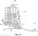 Fig. 05 - LOWER LIMB PROSTHESIS