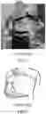 Fig. 02 - Harness for coupling to an upper arm prosthesis, and systems and methods of making and using same