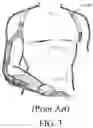 Fig. 03 - Harness for coupling to an upper arm prosthesis, and systems and methods of making and using same