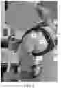Fig. 09 - Harness for coupling to an upper arm prosthesis, and systems and methods of making and using same