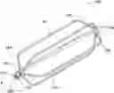 Fig. 01 - PATENT DUCTUS ARTERIOSUS STENT