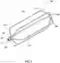 Fig. 02 - PATENT DUCTUS ARTERIOSUS STENT